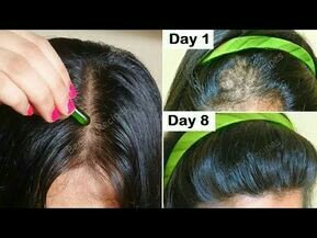 Apply evion on hairs 